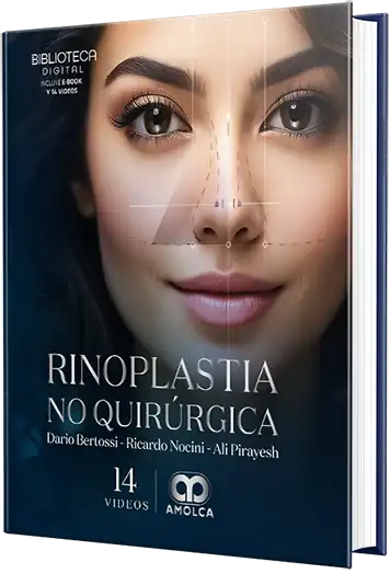 Rinoplastia no quirúrgica