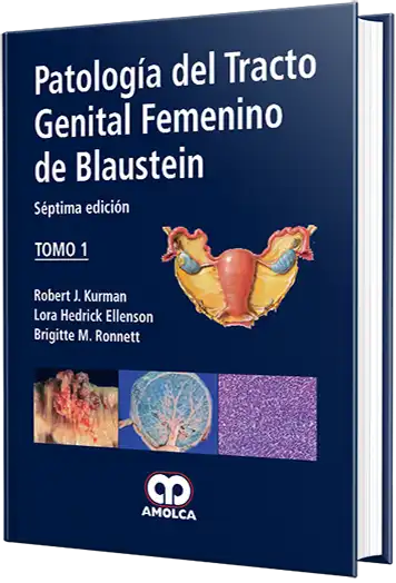 Patología del Tracto Genital Femenino de Blaustein - 6 edición