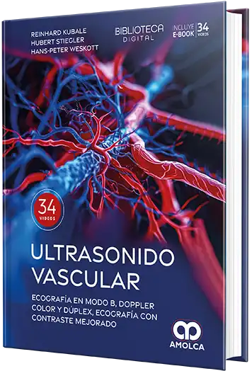 Ultrasonido vascular. Ecografía en Modo B, Doppler color y dúplex, ecografía con contraste mejorado