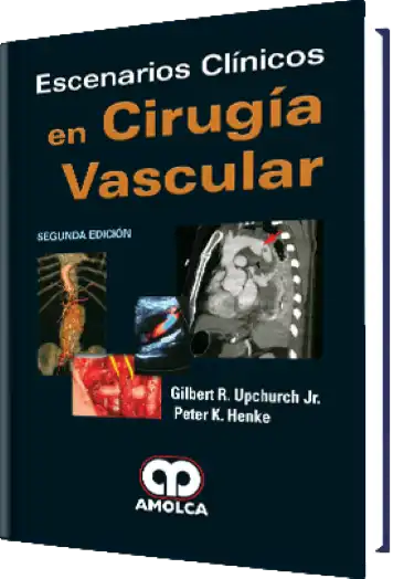 Escenarios Clínicos en Cirugía Vascular. 2 edición