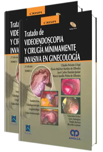 Tratado de Videoendoscopia y Cirugía Mínimamente Invasiva en Ginecología. 2 Edición