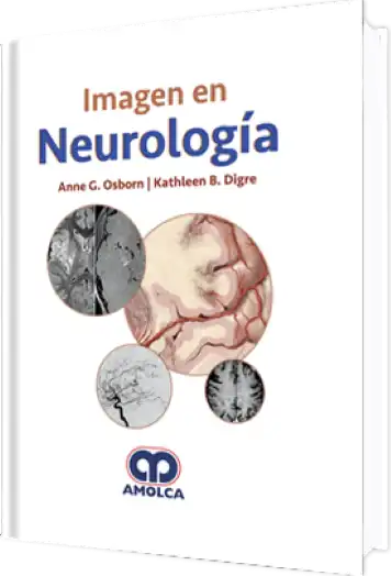 Imagen en Neurología