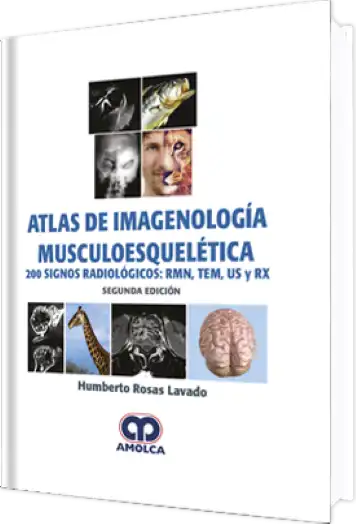 Atlas de Imagenología Musculoesquelética. 2 Edición