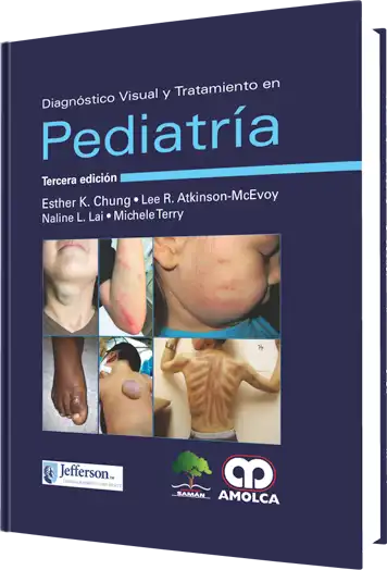 Diagnóstico visual y tratamiento en Pediatría.  3 edición