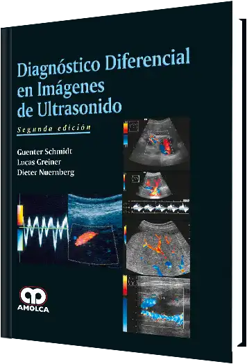 Diagnóstico Diferencial en Imágenes de Ultrasonido. 2 Edición