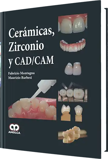 Cerámicas, Zirconio y CAD/CAM
