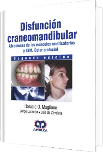 Disfunción Craneomandibular 2 edición