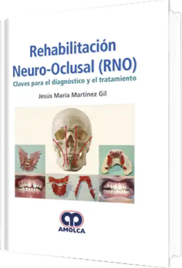 Rehabilitación Neuro-Oclusal (RNO)