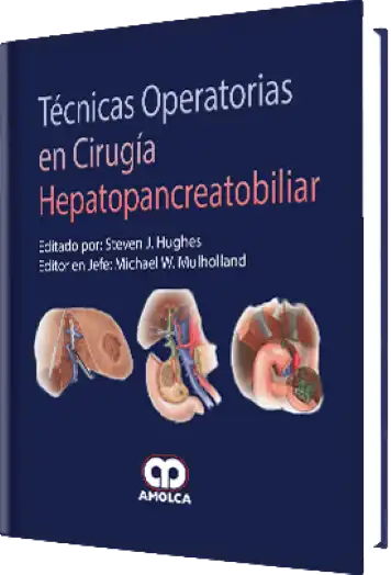 Técnicas Operatorias en Cirugía Hepatopancreatobiliar