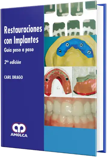 Restauraciones con Implantes. Guía Paso a Paso. 2 edición