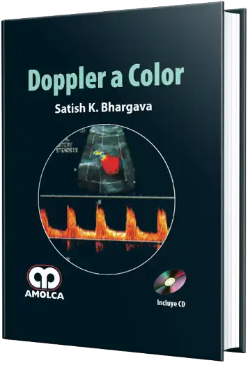 Doppler a Color