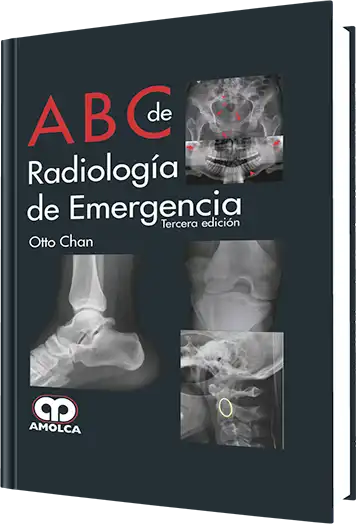 ABC de Radiología de Emergencia. 3 edición