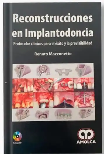 Reconstrucciones en Implantodoncia