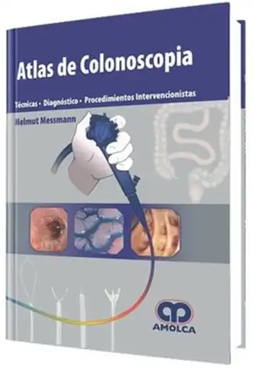 Atlas de Colonoscopia