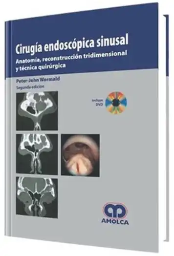 Cirugía endoscópica sinusal. 2 Edición