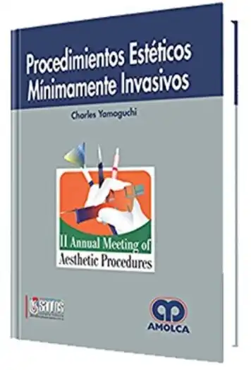 Procedimientos Estéticos Mínimamente Invasivos, 2 Edición